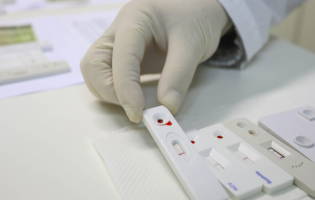 Brasil registra aumento de 22% nos novos casos de HIV desde 2010, aponta relatório da ONU