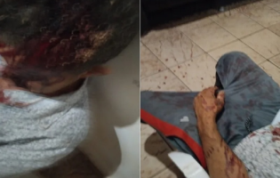Homem é espancado com pedaço de madeira e fica cerca de 24 horas desacordado após ataque na zona rural de Brumado